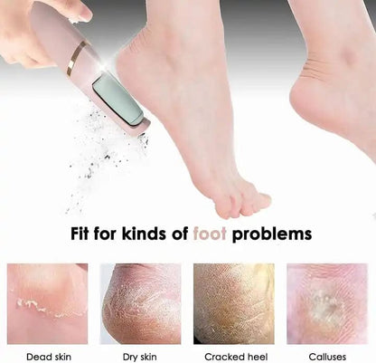 Electric Foot Callus Remover