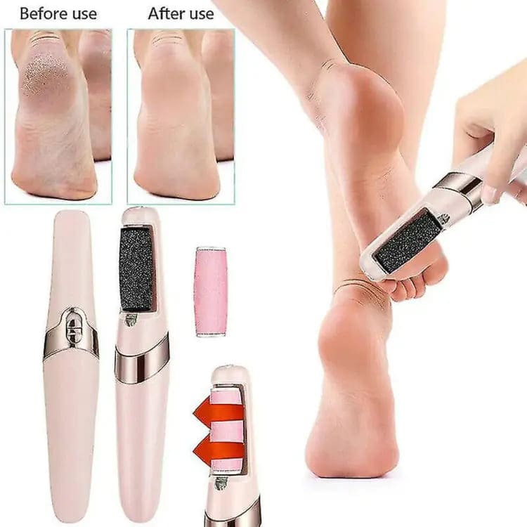 Electric Foot Callus Remover