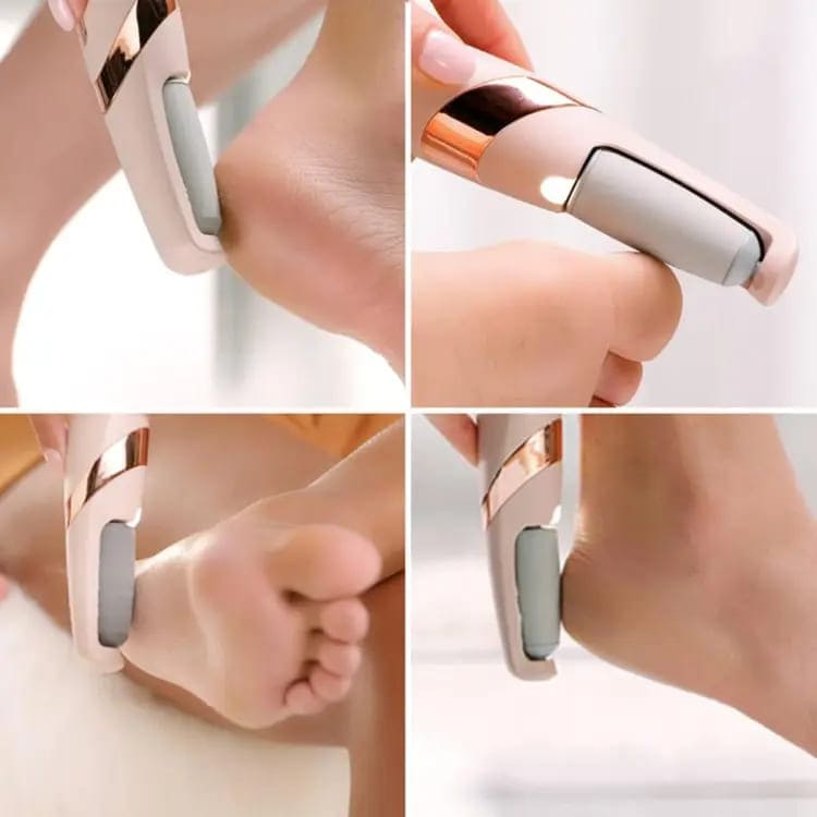 Electric Foot Callus Remover