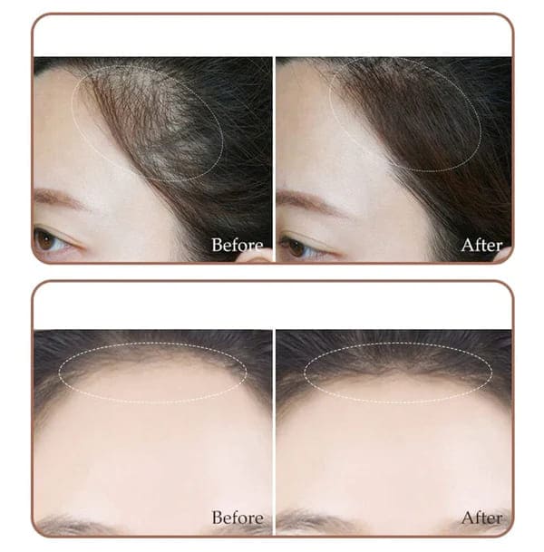 2 In1 Hairline and Eyebrow Shaping Stamp